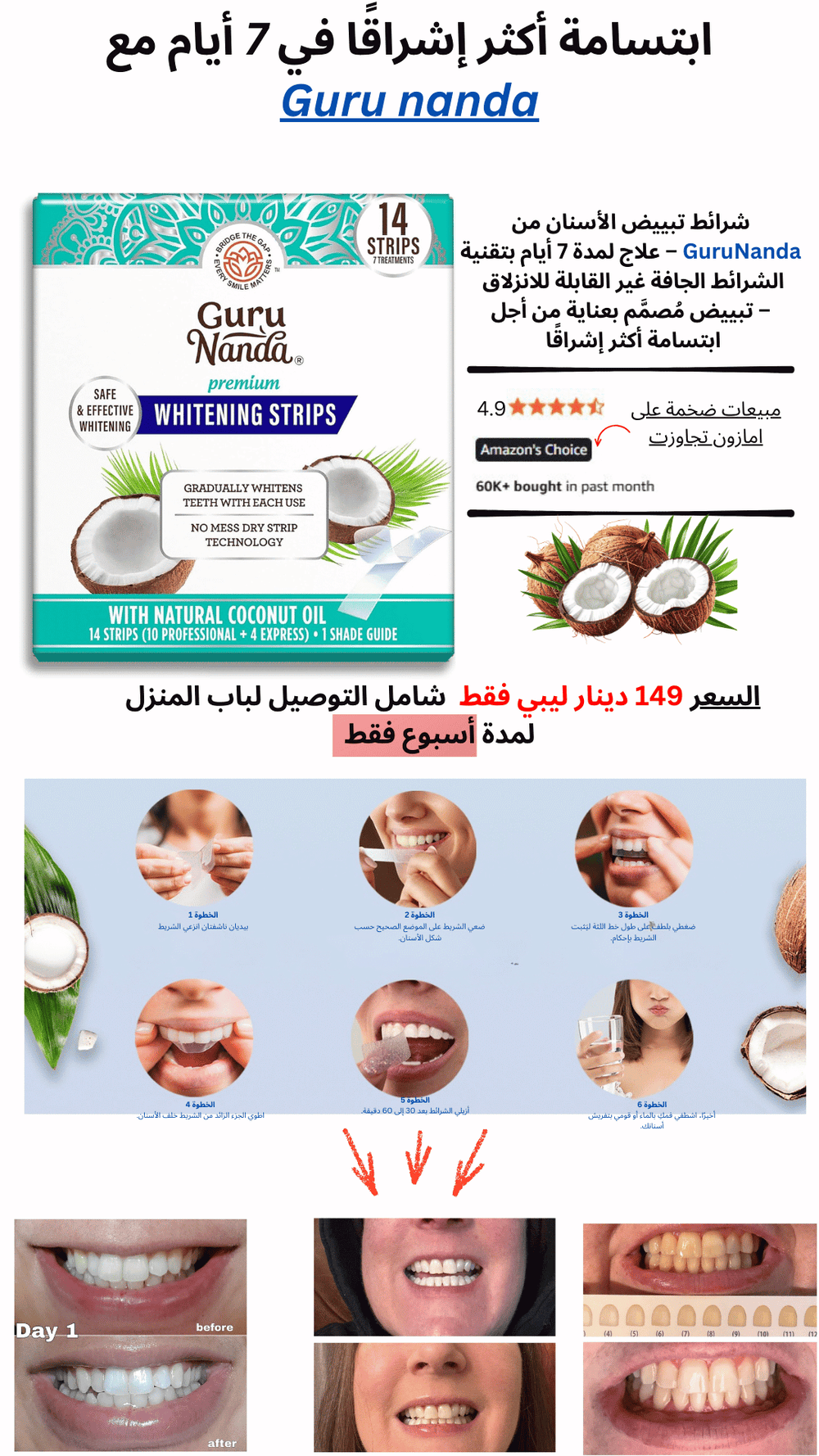 شرائط تبييض الأسنان GURU NANDA