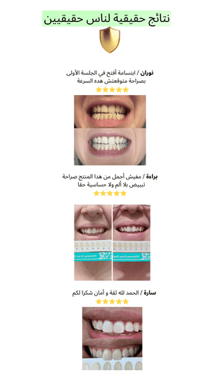 شرائط تبييض الأسنان GURU NANDA