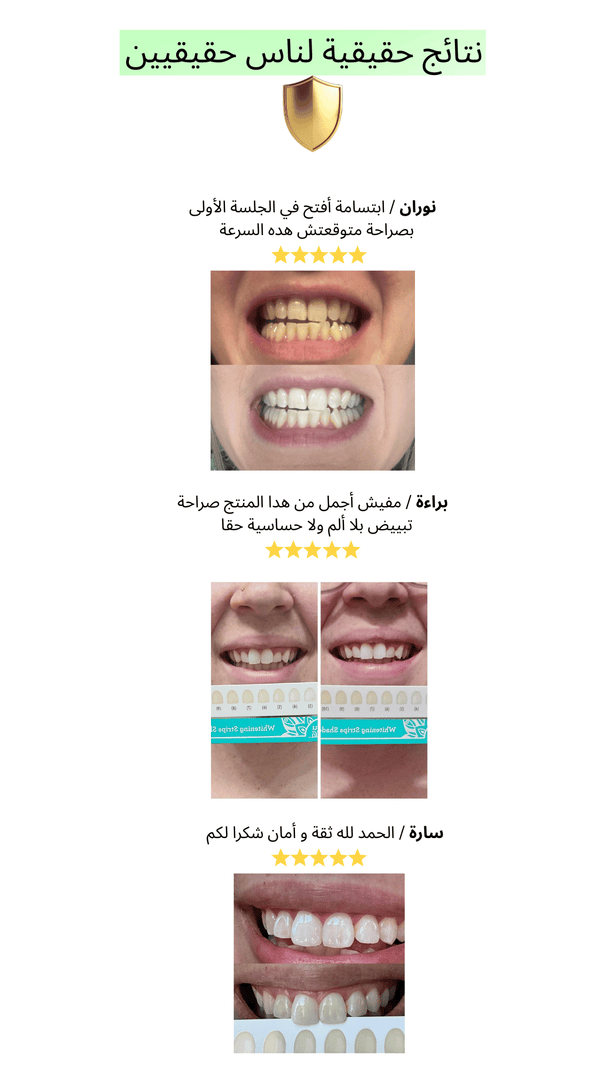 شرائط تبييض الأسنان GURU NANDA