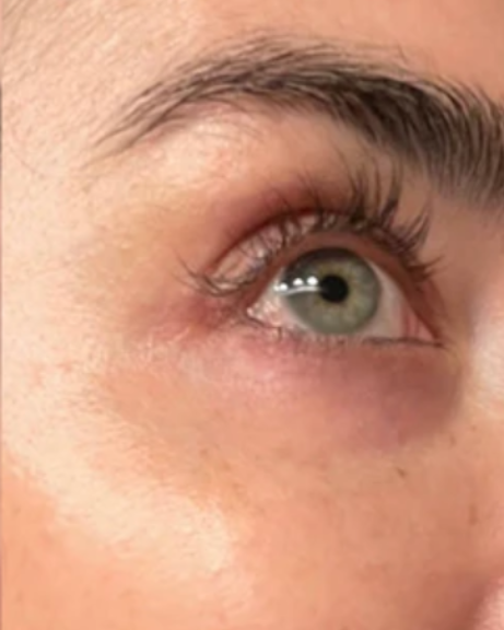 Close-up of a person's eye with visible eyelashes and skin texture.